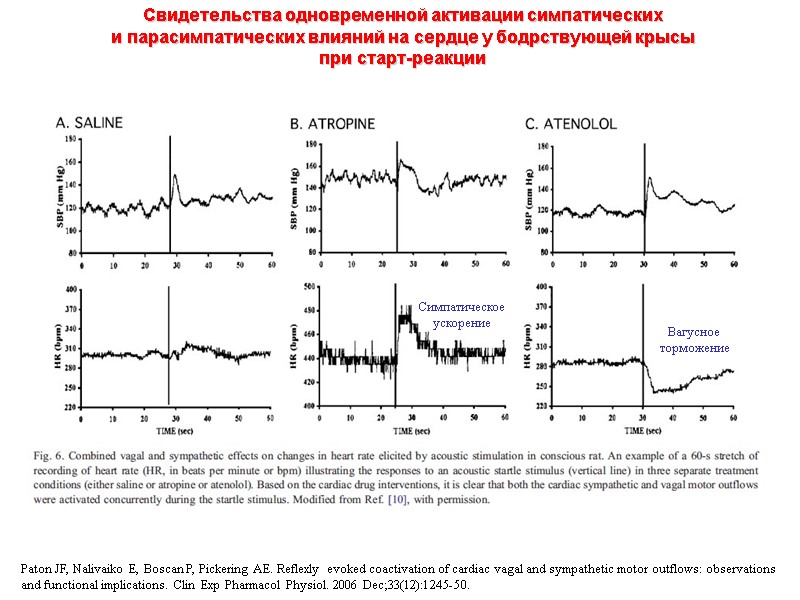 Paton JF, Nalivaiko E, Boscan P, Pickering AE. Reflexly evoked coactivation of cardiac vagal